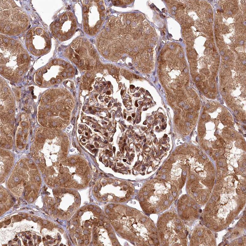 COPG Antibody - BSA Free Immunohistochemistry-Paraffin: COPG Antibody [NBP2-55178]