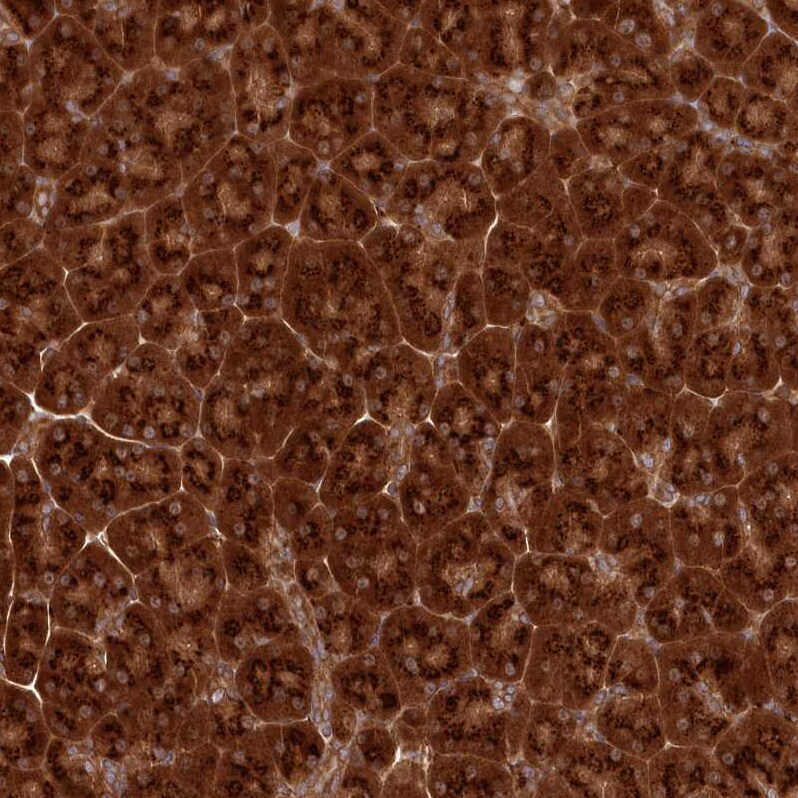 COPG Antibody - BSA Free Immunohistochemistry-Paraffin: COPG Antibody [NBP2-55178]