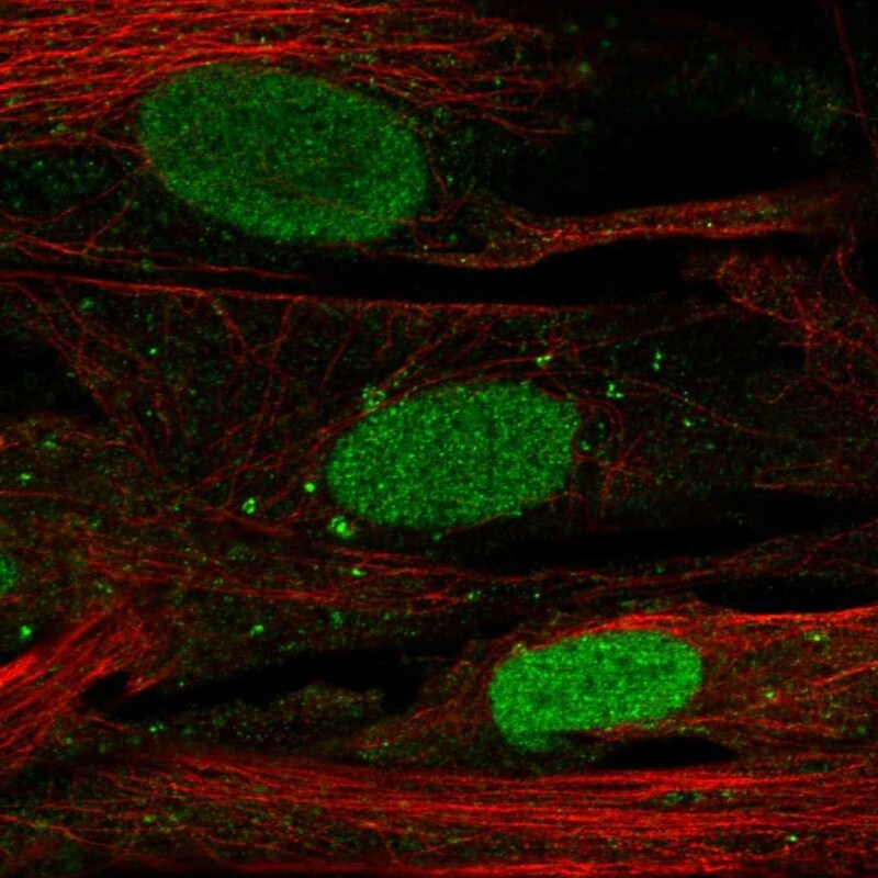 SHOX Antibody - BSA Free Immunocytochemistry/ Immunofluorescence: SHOX Antibody - BSA Free [NBP2-55181]
