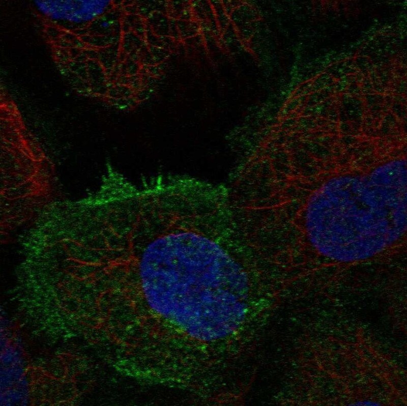 Tec Antibody - BSA Free Immunocytochemistry/ Immunofluorescence: Tec Antibody - BSA Free [NBP2-55192]