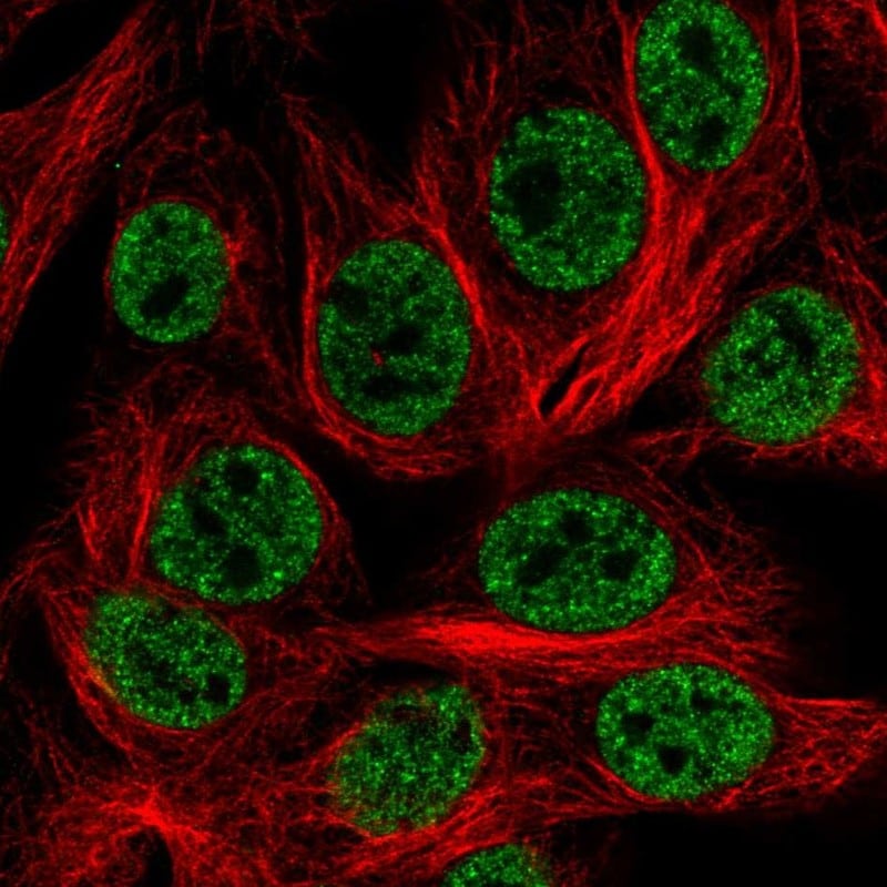 HOXD1 Antibody - BSA Free Immunocytochemistry/ Immunofluorescence: HOXD1 Antibody - BSA Free [NBP2-55201]