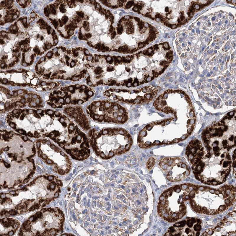 DHTKD1 Antibody - BSA Free Immunohistochemistry-Paraffin: DHTKD1 Antibody [NBP2-55215]