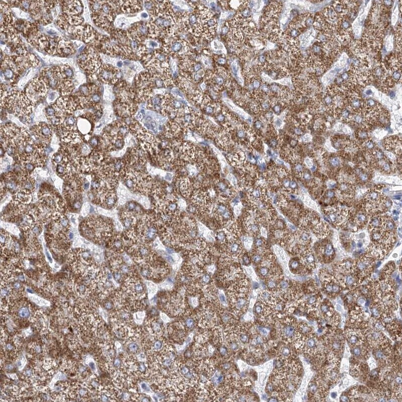 DHTKD1 Antibody - BSA Free Immunohistochemistry-Paraffin: DHTKD1 Antibody [NBP2-55215]