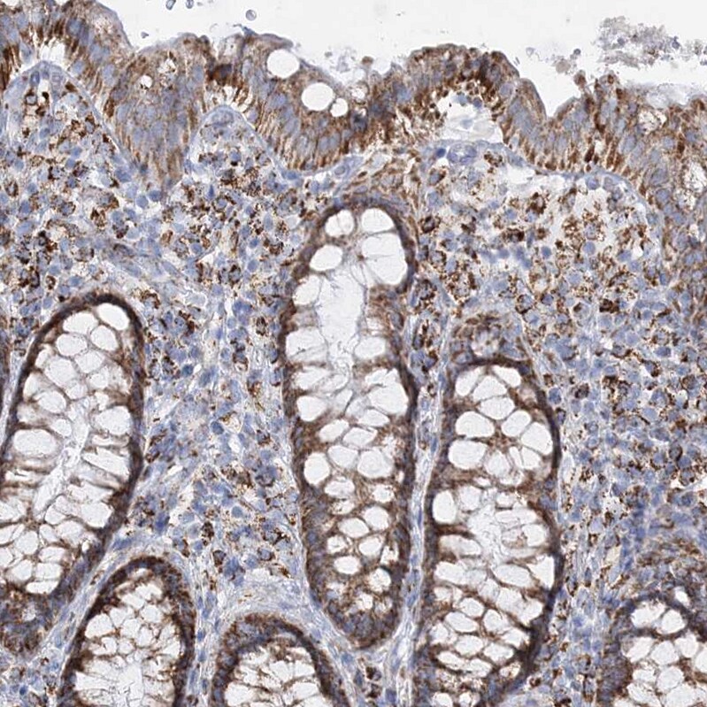 DHTKD1 Antibody - BSA Free Immunohistochemistry-Paraffin: DHTKD1 Antibody [NBP2-55215]