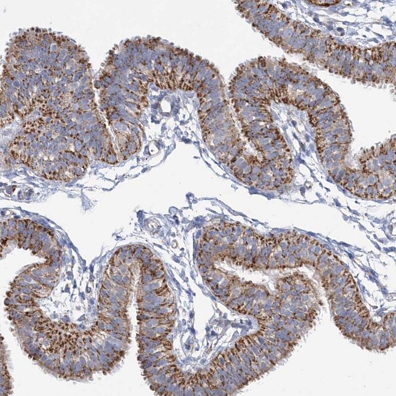 DHTKD1 Antibody - BSA Free Immunohistochemistry-Paraffin: DHTKD1 Antibody [NBP2-55215]