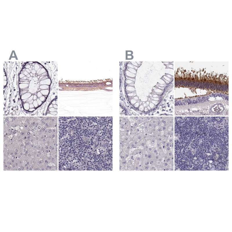 GRK1 Antibody - BSA Free Immunohistochemistry: GRK1 Antibody - BSA Free [NBP2-55226]