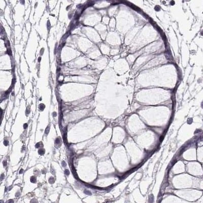 GRK1 Antibody - BSA Free Immunohistochemistry: GRK1 Antibody - BSA Free [NBP2-55226]