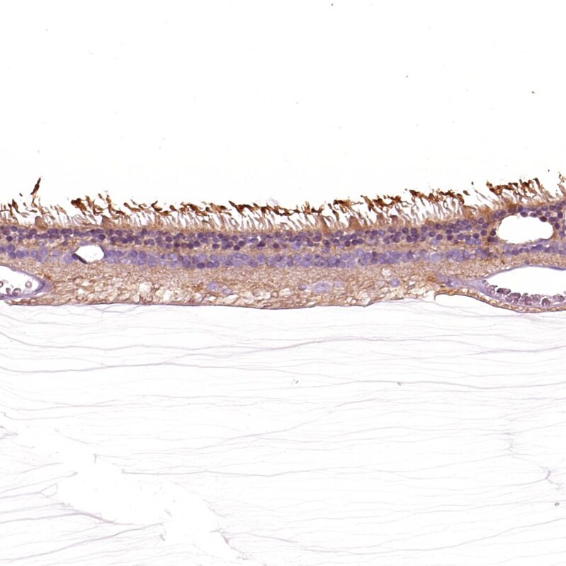 GRK1 Antibody - BSA Free Immunohistochemistry: GRK1 Antibody - BSA Free [NBP2-55226]