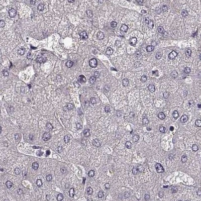 GRK1 Antibody - BSA Free Immunohistochemistry: GRK1 Antibody - BSA Free [NBP2-55226]