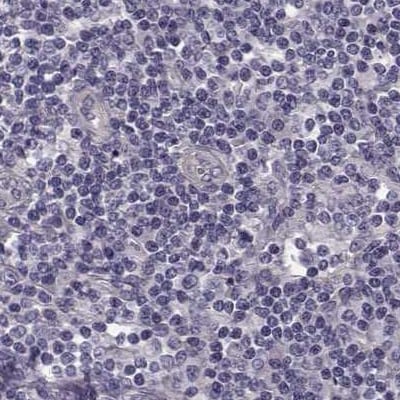 GRK1 Antibody - BSA Free Immunohistochemistry: GRK1 Antibody - BSA Free [NBP2-55226]