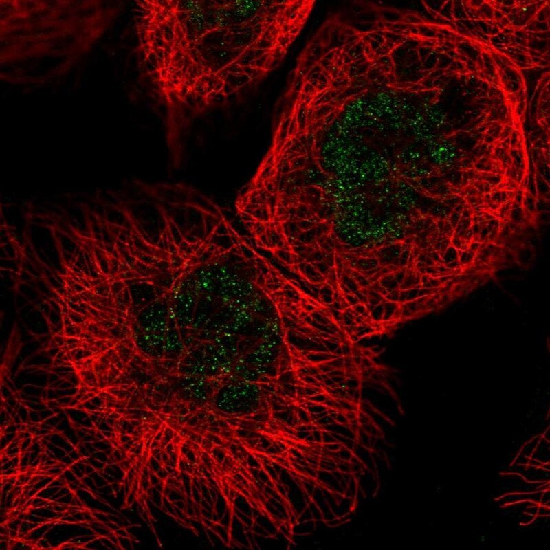 FANCC Antibody - BSA Free Immunocytochemistry/ Immunofluorescence: FANCC Antibody [NBP2-55256]