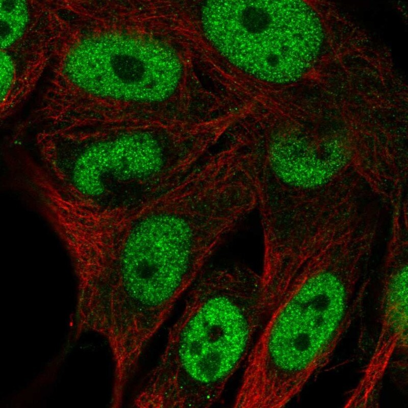 GAL3ST4 Antibody - BSA Free Immunocytochemistry/ Immunofluorescence: GAL3ST4 Antibody - BSA Free [NBP2-55274]