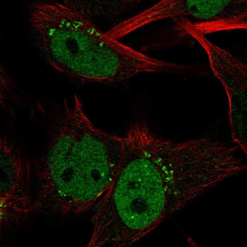Claspin Antibody - BSA Free Immunocytochemistry/ Immunofluorescence: Claspin Antibody - BSA Free [NBP2-55290]