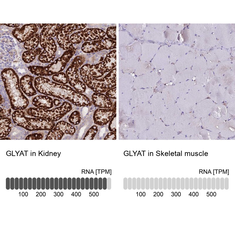 GLYAT Antibody - BSA Free Immunohistochemistry-Paraffin: GLYAT Antibody [NBP2-55298]