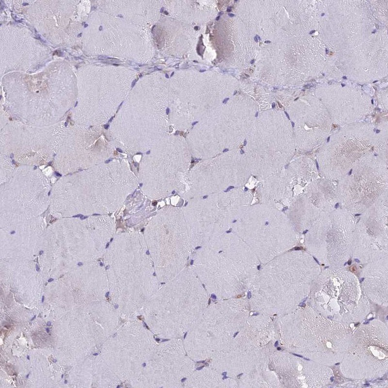 GLYAT Antibody - BSA Free Immunohistochemistry-Paraffin: GLYAT Antibody [NBP2-55298]