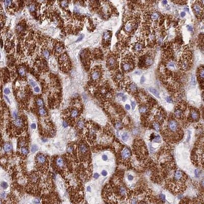 GLYAT Antibody - BSA Free Immunohistochemistry-Paraffin: GLYAT Antibody [NBP2-55298]