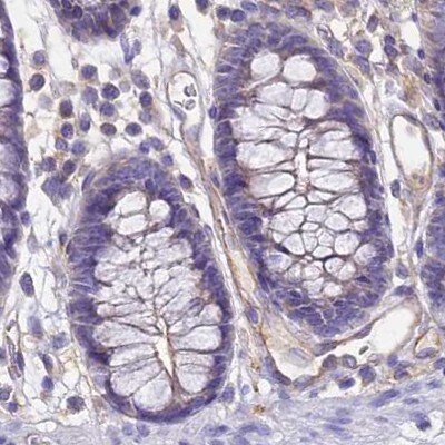 GLYAT Antibody - BSA Free Immunohistochemistry-Paraffin: GLYAT Antibody [NBP2-55298]