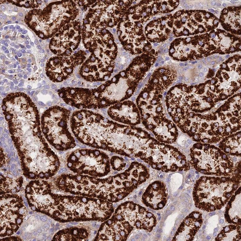 GLYAT Antibody - BSA Free Immunohistochemistry-Paraffin: GLYAT Antibody [NBP2-55298]