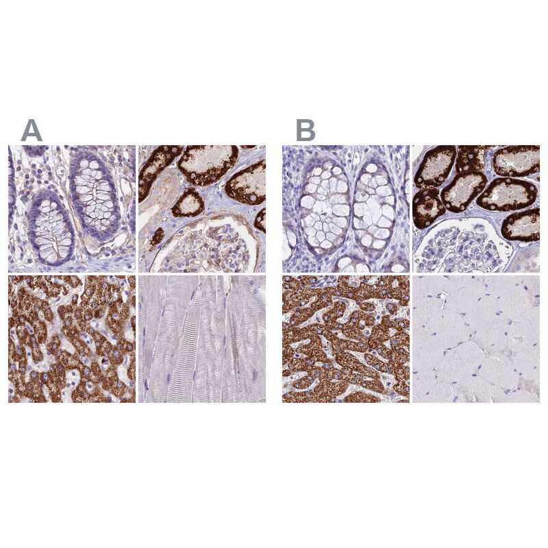 GLYAT Antibody - BSA Free Immunohistochemistry-Paraffin: GLYAT Antibody [NBP2-55298]
