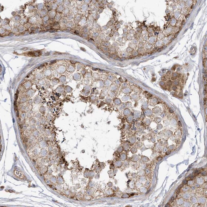 cGAS Antibody - BSA Free Immunohistochemistry-Paraffin: cGAS Antibody [NBP2-55374]