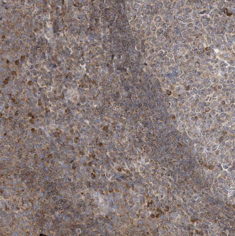 cGAS Antibody - BSA Free Immunohistochemistry-Paraffin: cGAS Antibody [NBP2-55374]