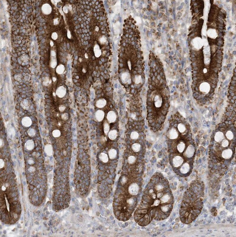 cGAS Antibody - BSA Free Immunohistochemistry-Paraffin: cGAS Antibody [NBP2-55374]