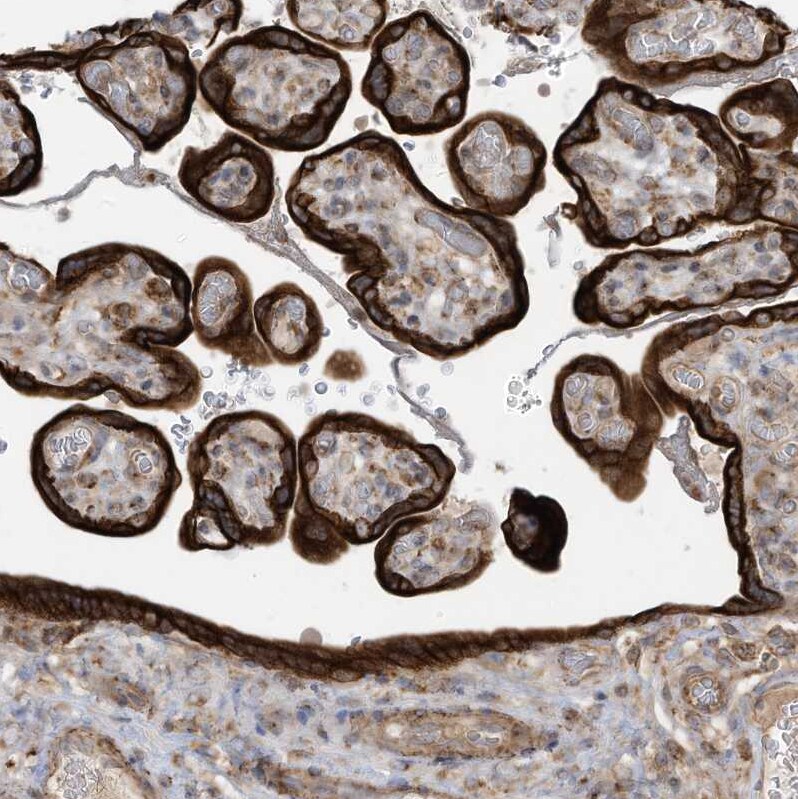 cGAS Antibody - BSA Free Immunohistochemistry-Paraffin: cGAS Antibody [NBP2-55374]