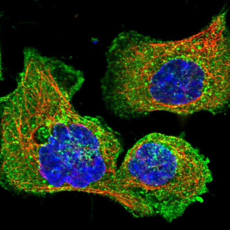 CLTB Antibody - BSA Free Immunocytochemistry/ Immunofluorescence: CLTB Antibody [NBP2-55390]
