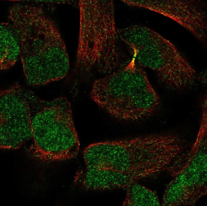 PKNOX2 Antibody - BSA Free Immunocytochemistry/ Immunofluorescence: PKNOX2 Antibody - BSA Free [NBP2-55463]