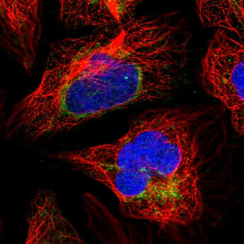 SUCLA2 Antibody - BSA Free Immunocytochemistry/ Immunofluorescence: SUCLA2 Antibody [NBP2-55488]