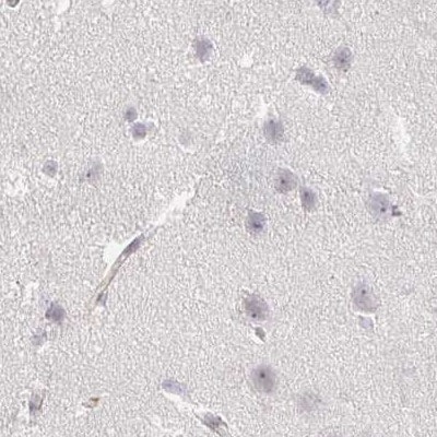 Aggrecan Antibody - BSA Free Immunohistochemistry: Aggrecan Antibody - BSA Free [NBP2-55540]
