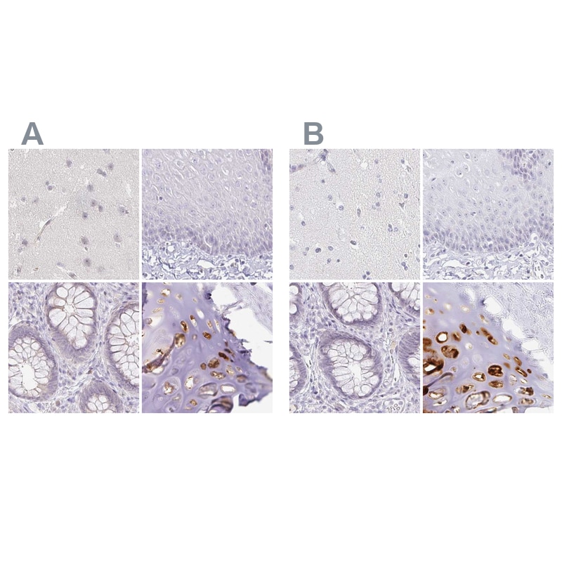 Aggrecan Antibody - BSA Free Immunohistochemistry: Aggrecan Antibody - BSA Free [NBP2-55540]