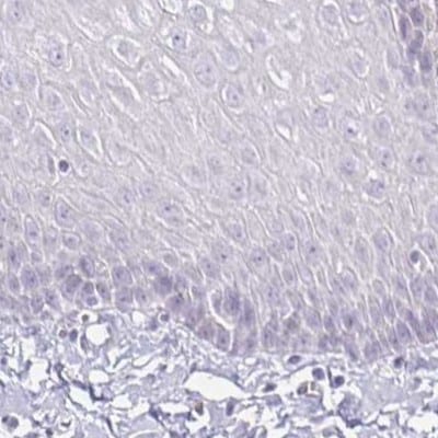 Aggrecan Antibody - BSA Free Immunohistochemistry: Aggrecan Antibody - BSA Free [NBP2-55540]