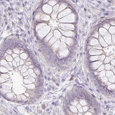 Aggrecan Antibody - BSA Free Immunohistochemistry: Aggrecan Antibody - BSA Free [NBP2-55540]