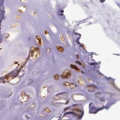 Aggrecan Antibody - BSA Free Immunohistochemistry: Aggrecan Antibody - BSA Free [NBP2-55540]
