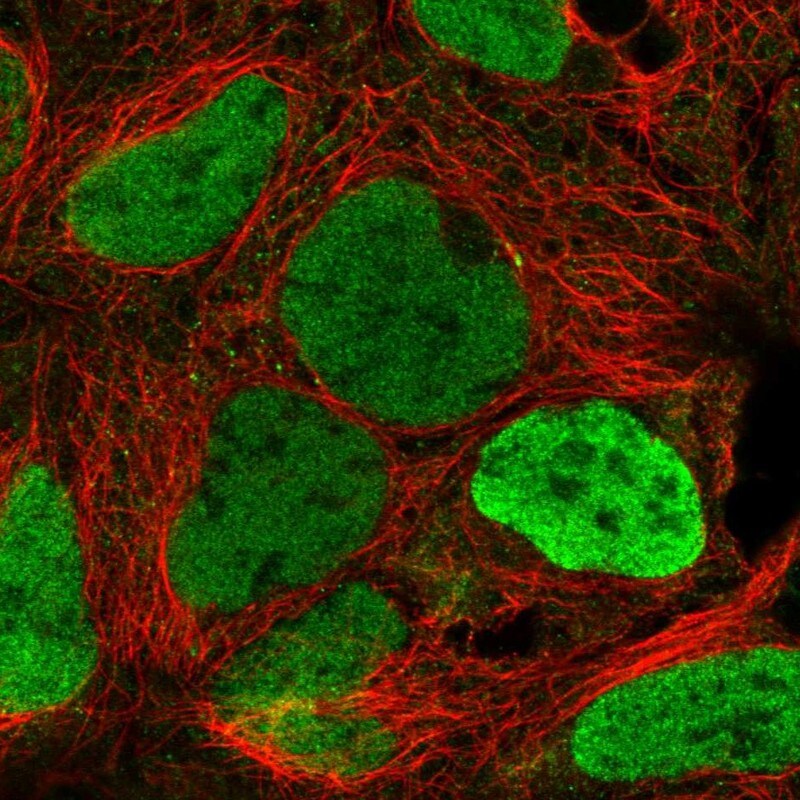 SMCX Antibody - BSA Free Immunocytochemistry/ Immunofluorescence: SMCX Antibody [NBP2-55541]