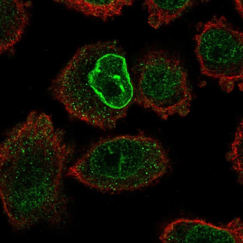 RAMP1 Antibody Immunocytochemistry/ Immunofluorescence: RAMP1 Antibody [RAMP1 Antibody]