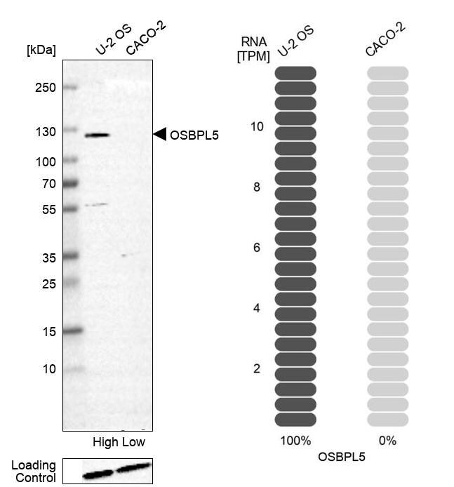 OSBPL5 Antibody - BSA Free Western Blot: OSBPL5 Antibody - BSA Free [NBP2-55591]