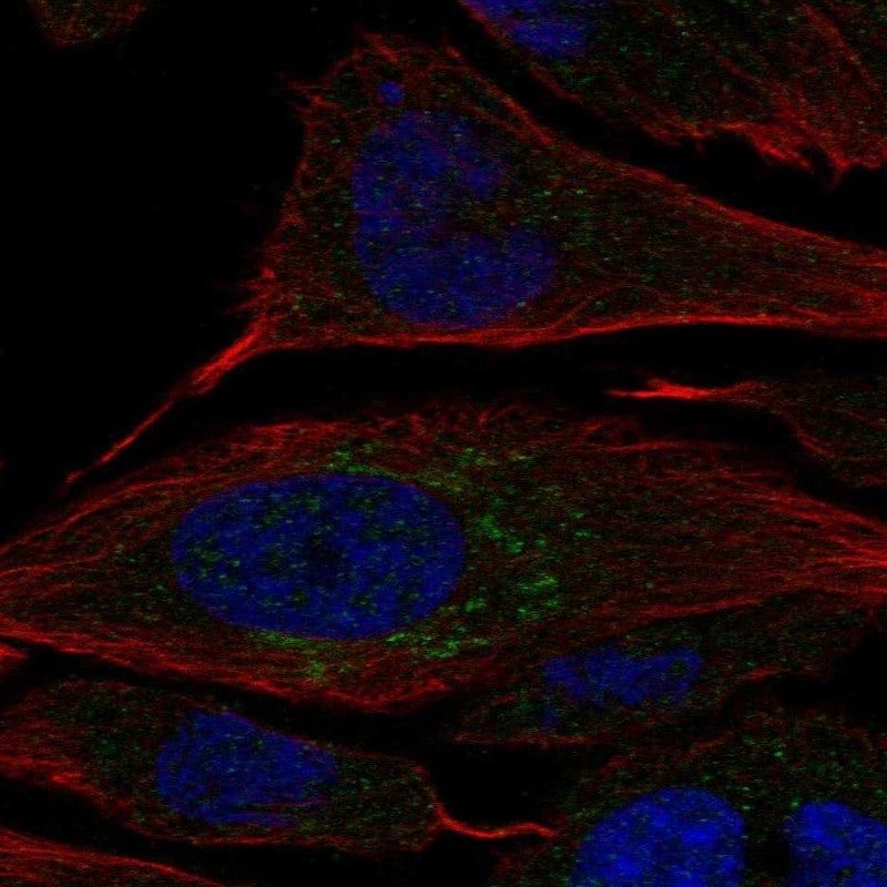 Carbohydrate Sulfotransferase 2/CHST2 Antibody - BSA Free Immunocytochemistry/ Immunofluorescence: Carbohydrate Sulfotransferase 2/CHST2 Antibody - BSA Free [NBP2-55604]