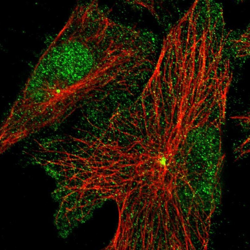 PRICKLE3 Antibody - BSA Free Immunocytochemistry/ Immunofluorescence: PRICKLE3 Antibody - BSA Free [NBP2-55605]
