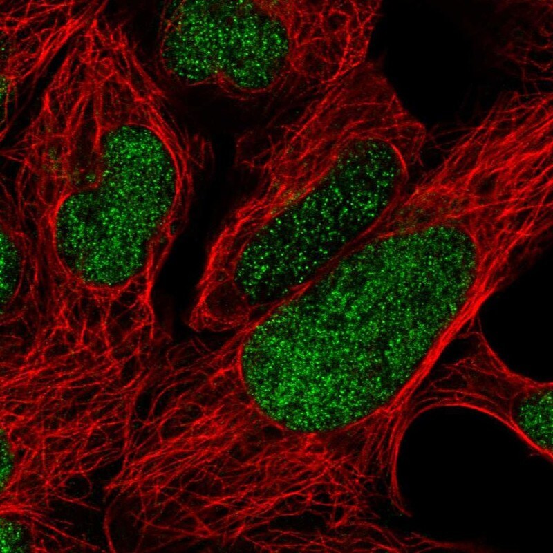 FoxP2 Antibody - BSA Free Immunocytochemistry/ Immunofluorescence: FoxP2 Antibody [NBP2-55618]