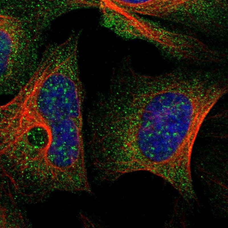GilZ Antibody - BSA Free Immunocytochemistry/ Immunofluorescence: GilZ Antibody [NBP2-55645]