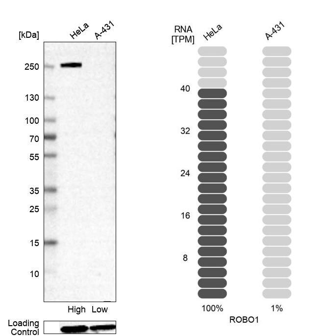 ROBO1 Antibody - BSA Free Western Blot: ROBO1 Antibody - BSA Free [NBP2-55652]