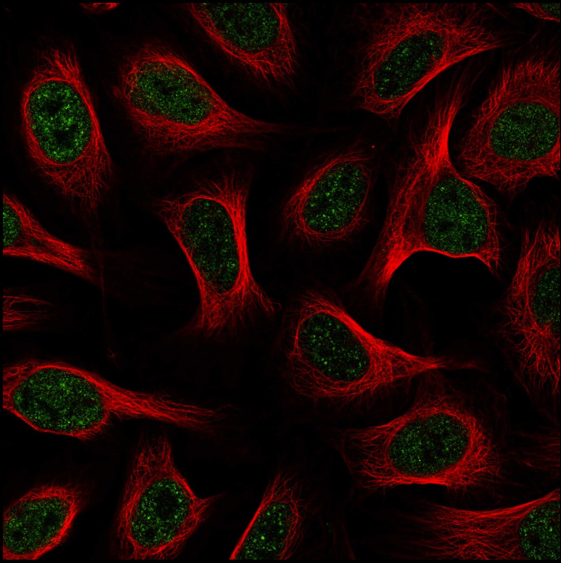 G9a/EHMT2 Antibody - BSA Free Immunocytochemistry/ Immunofluorescence - G9a/EHMT2 Antibody [NBP2-55881]