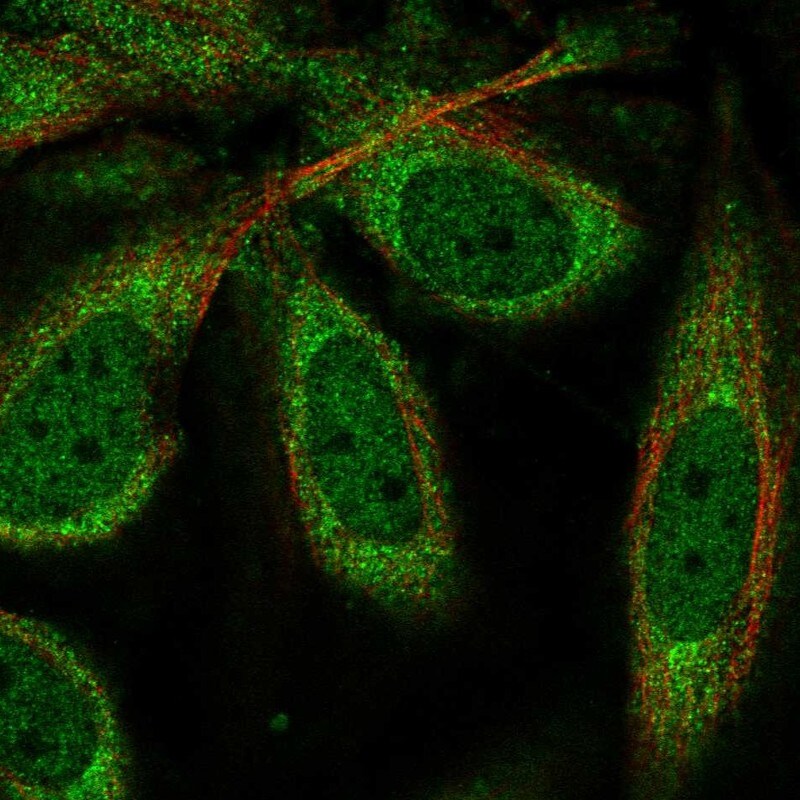 CPEB1 Antibody - BSA Free Immunocytochemistry/ Immunofluorescence: CPEB1 Antibody - BSA Free [NBP2-56162]