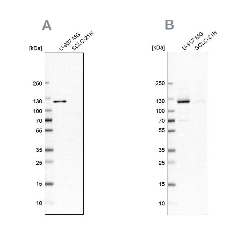 ARHGEF1 Antibody Western Blot: ARHGEF1 Antibody Antibody [NBP2-56320]