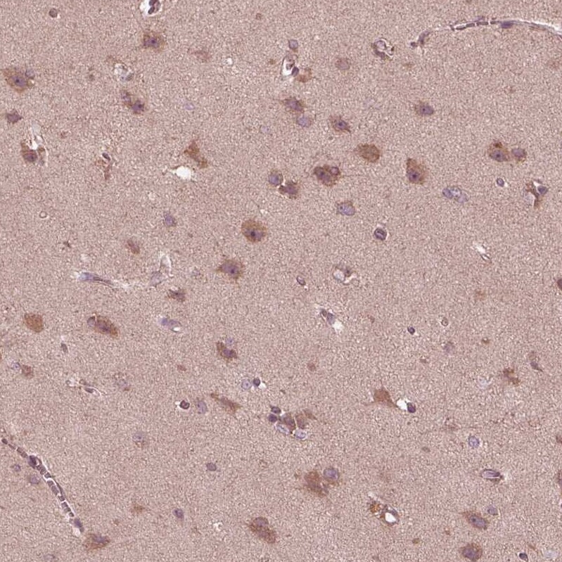 PI 3-Kinase p85 beta Antibody - BSA Free Immunohistochemistry: PI 3-Kinase p85 beta Antibody - BSA Free [NBP2-56360]