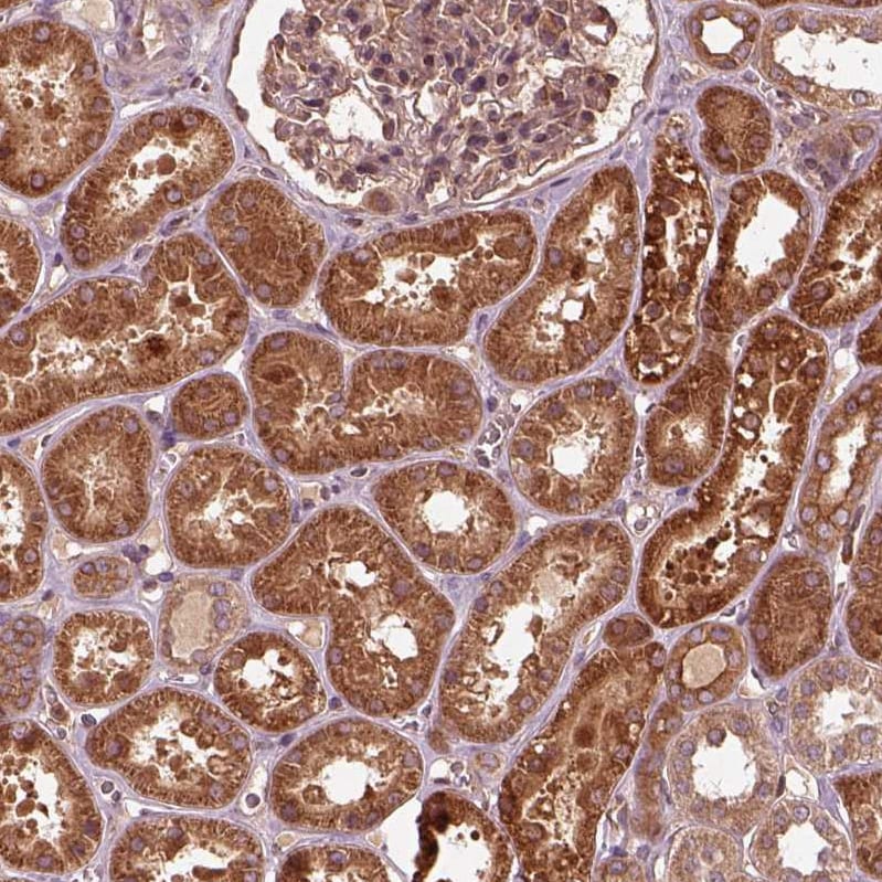 PI 3-Kinase p85 beta Antibody - BSA Free Immunohistochemistry: PI 3-Kinase p85 beta Antibody - BSA Free [NBP2-56360]