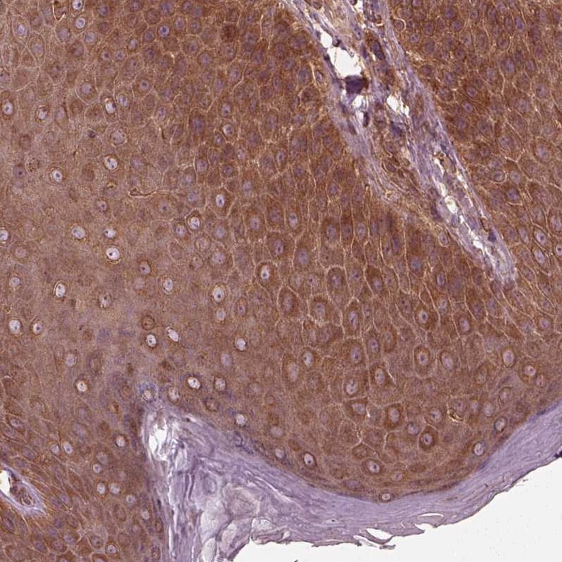 PI 3-Kinase p85 beta Antibody - BSA Free Immunohistochemistry: PI 3-Kinase p85 beta Antibody - BSA Free [NBP2-56360]