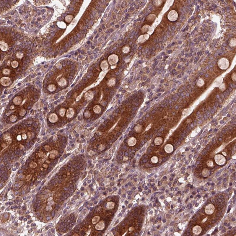 PI 3-Kinase p85 beta Antibody - BSA Free Immunohistochemistry: PI 3-Kinase p85 beta Antibody - BSA Free [NBP2-56360]